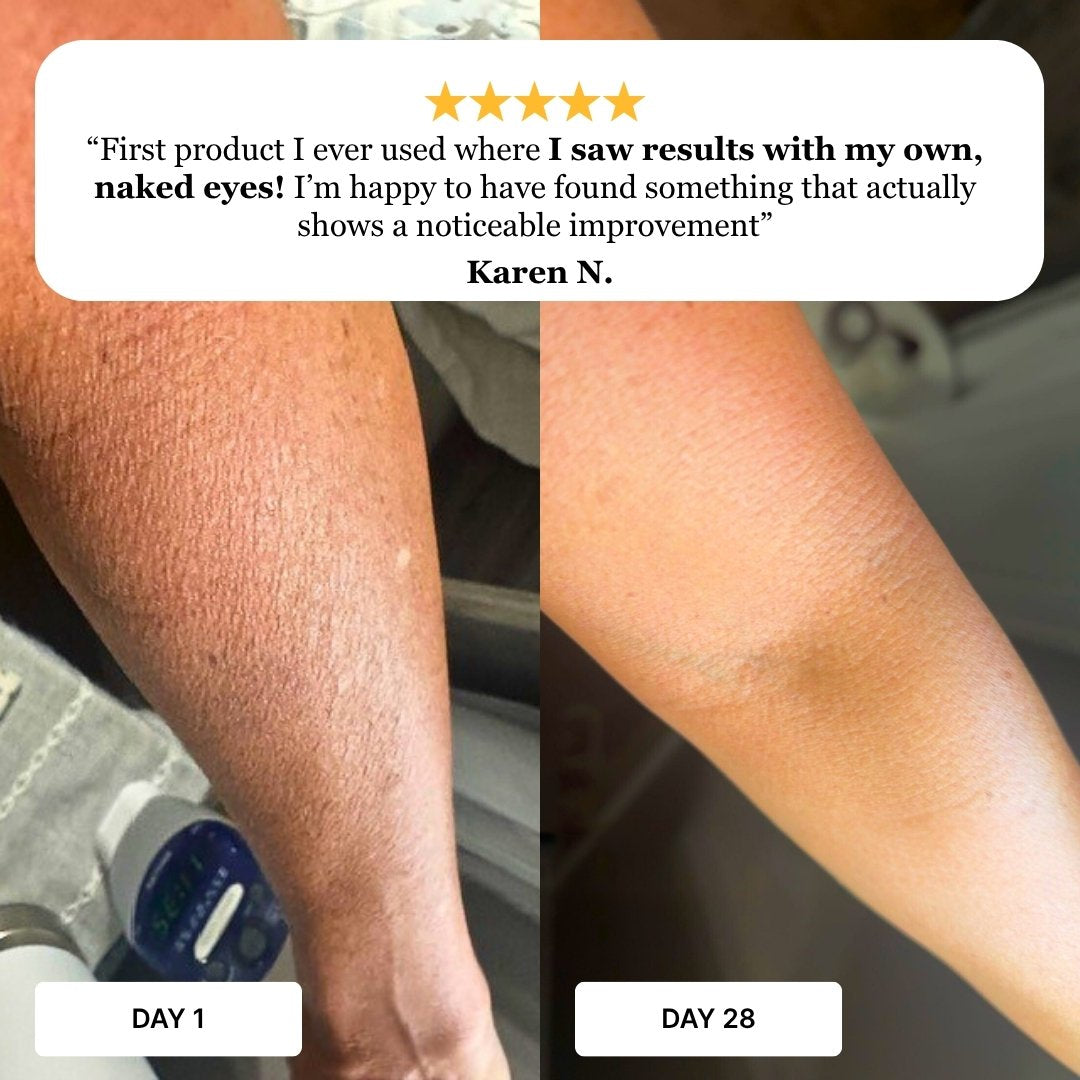 Customer-submitted Day 1 and Day 28 arm photos showing smoother-looking skin with a five-star Skin Restore testimonial from Karen.
