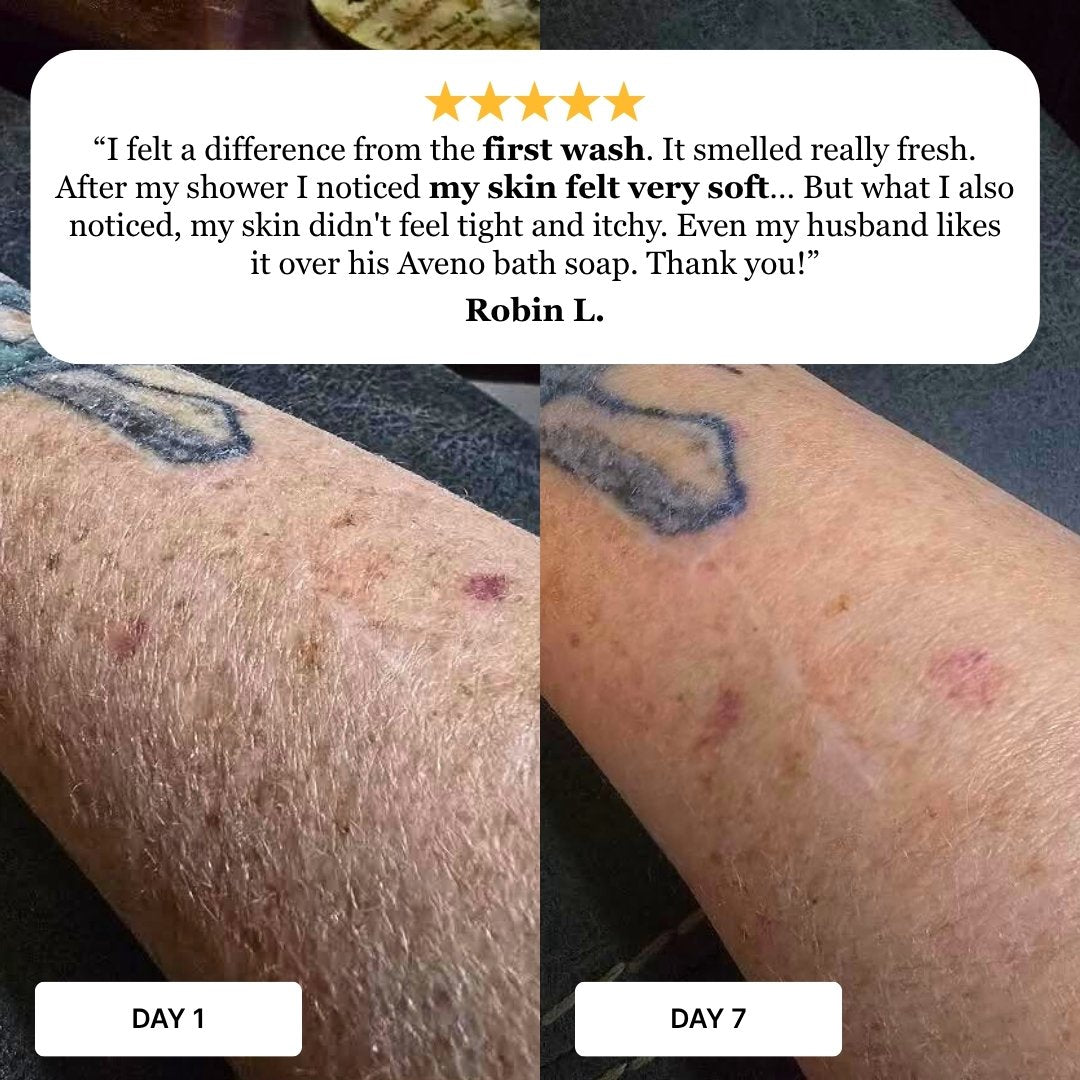 Customer-submitted Day 1 and Day 7 arm photos with a five-star testimonial describing softer skin after using Skin Restore soap.